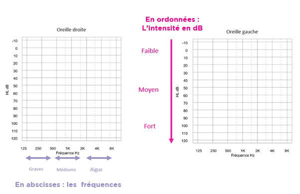 Audiogramme tonal axes du graphique, les fréquences en abscisse, et les décibels en ordonnée