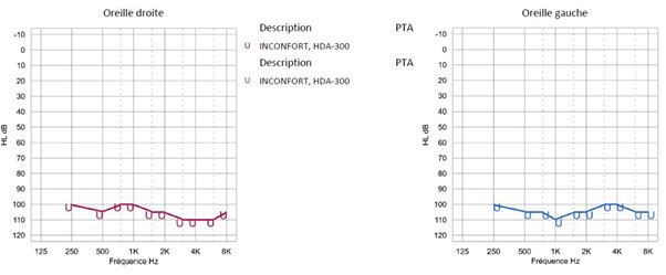 Audiogramme tonal avec seuils d'inconfort