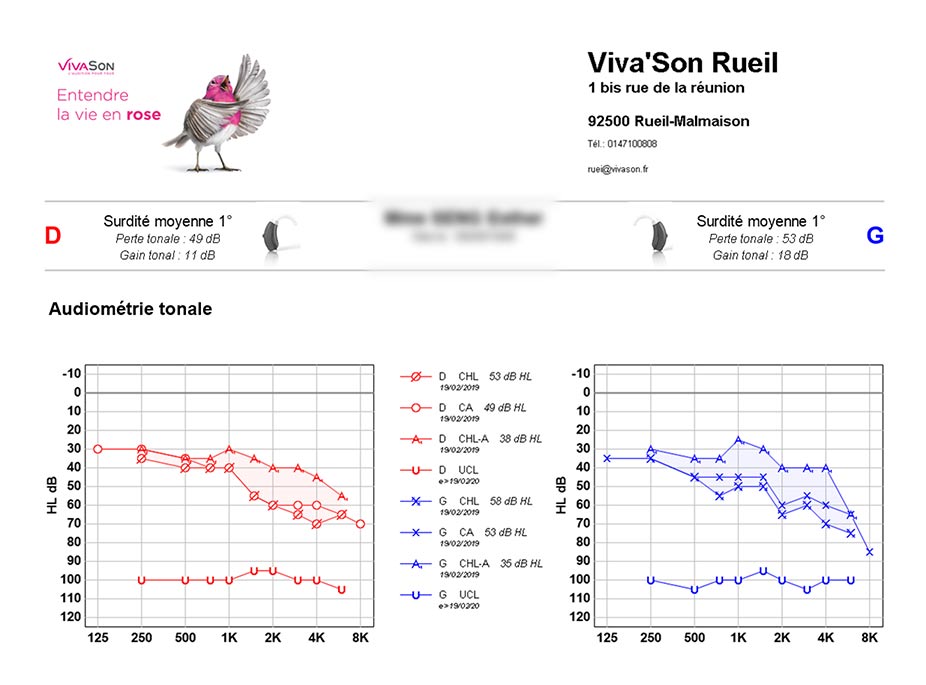 Exemple d'un audiogramme tonal par VIvaSon